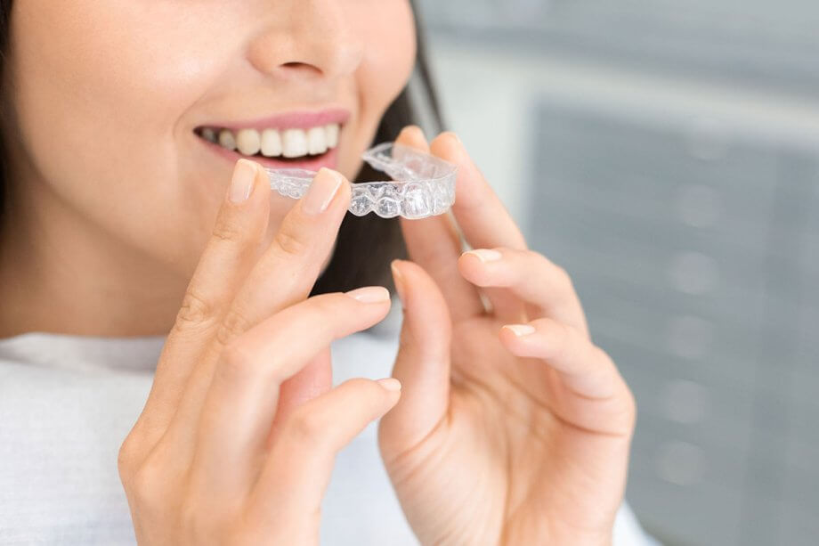 Can You Eat With Invisalign?