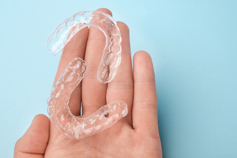 How Can Invisalign Help an Overbite?